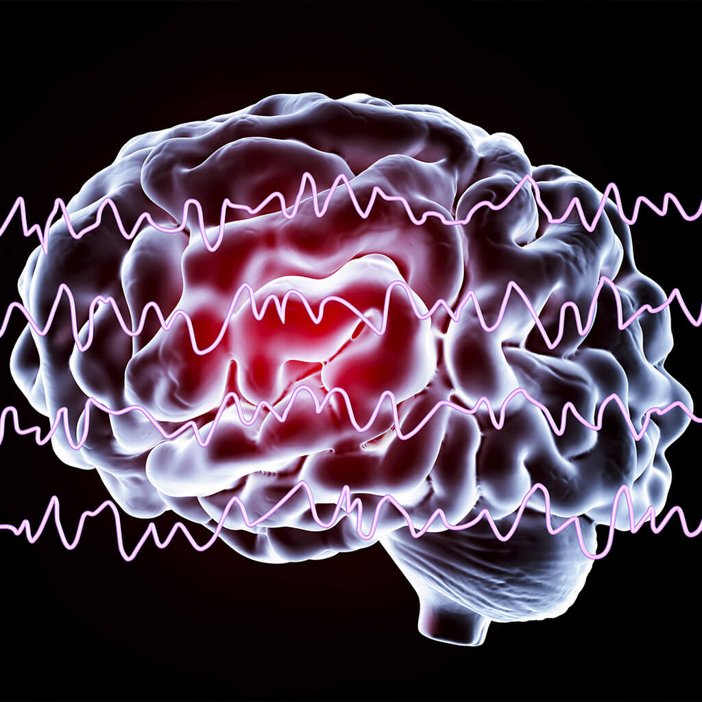 Epilepsy: causes and symptoms