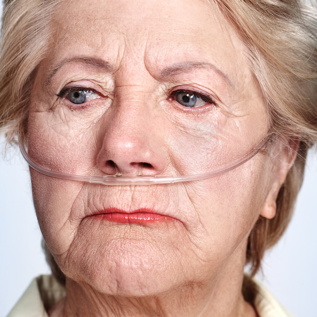 Enfermedad pulmonar obstructiva: ¿qué es?