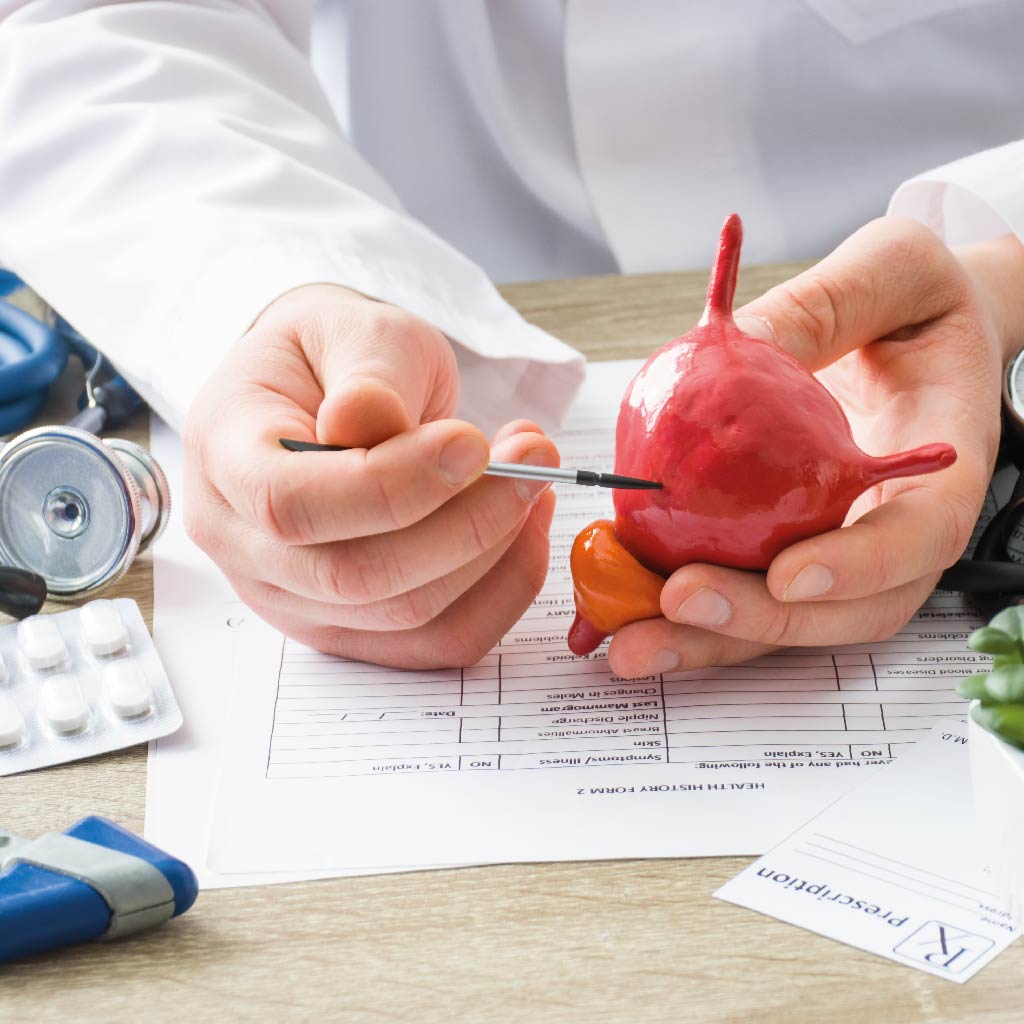 Bladder cancer: symptoms, diagnosis and treatment