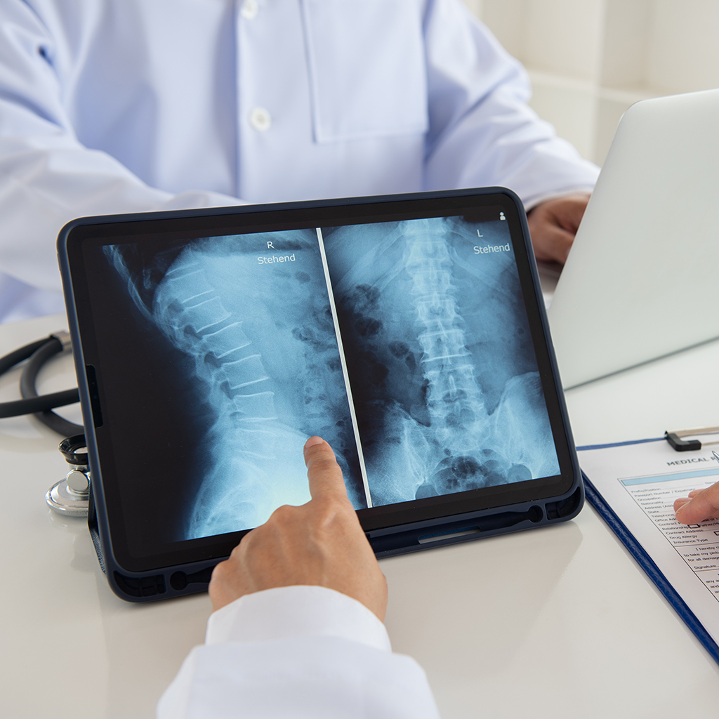 Full X-ray of the spine: what is it and why is it needed?