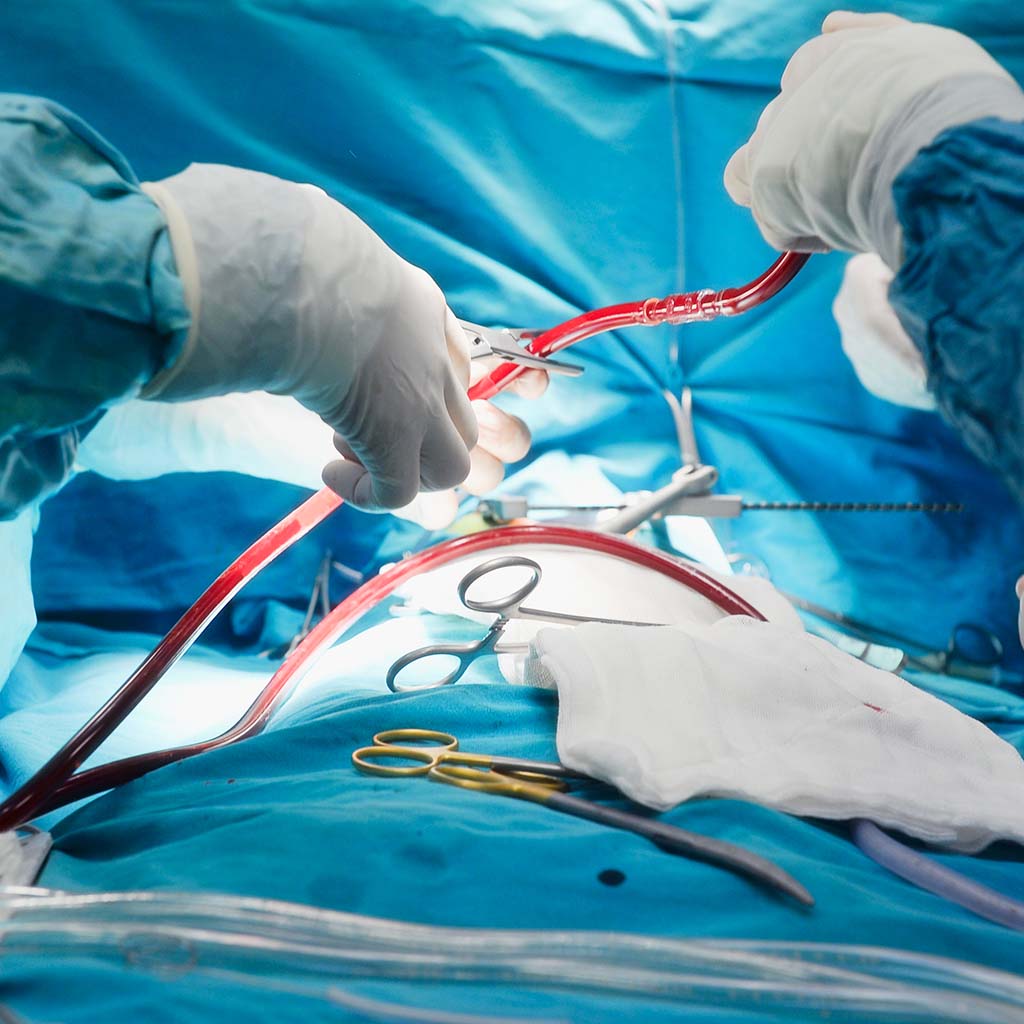 Una niña de 7 meses salvada gracias a una delicada cirugía cardíaca pediátrica