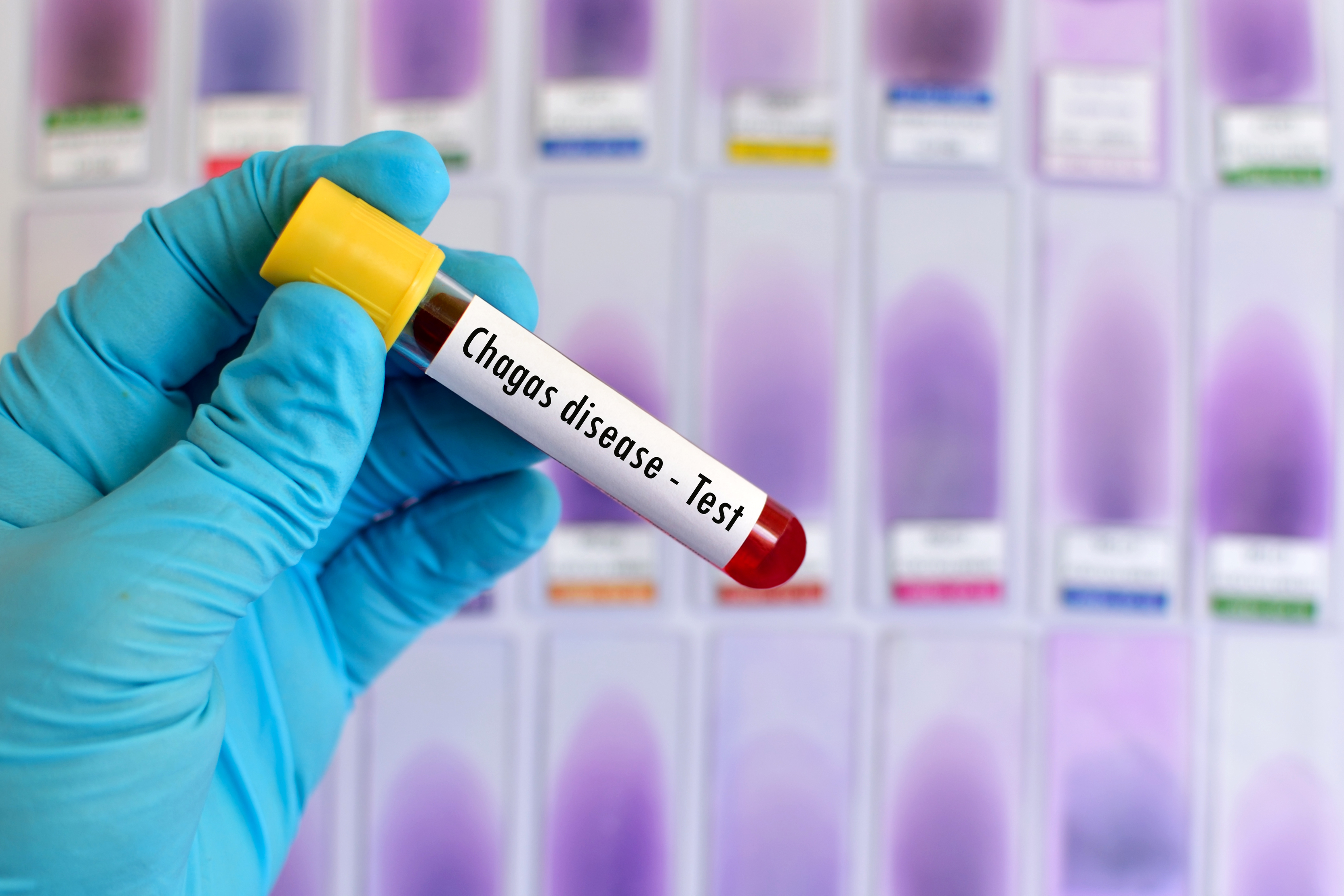 Enfermedad de Chagas: ¿qué es y cómo se transmite?