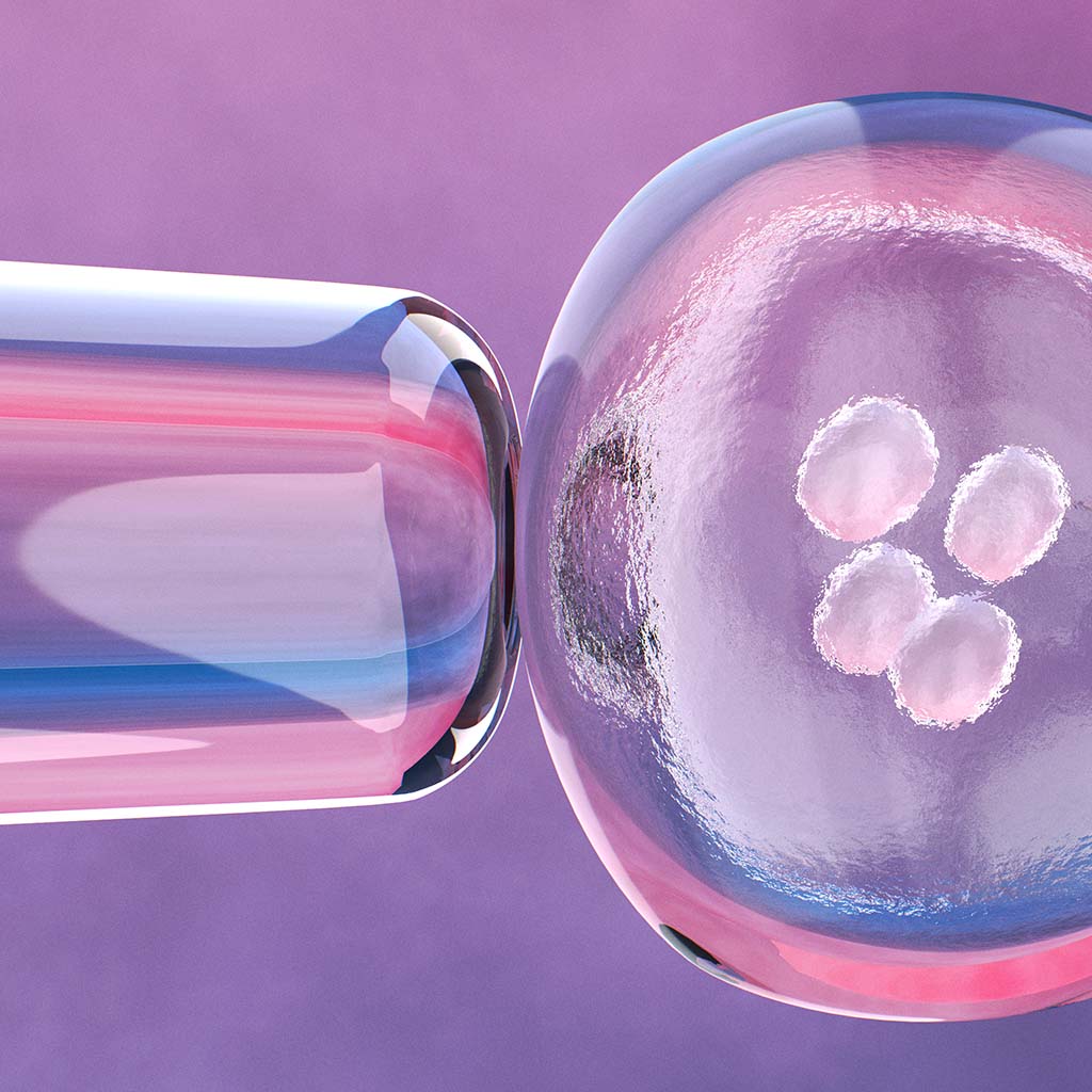 Embryo transfer: the right time for implantation