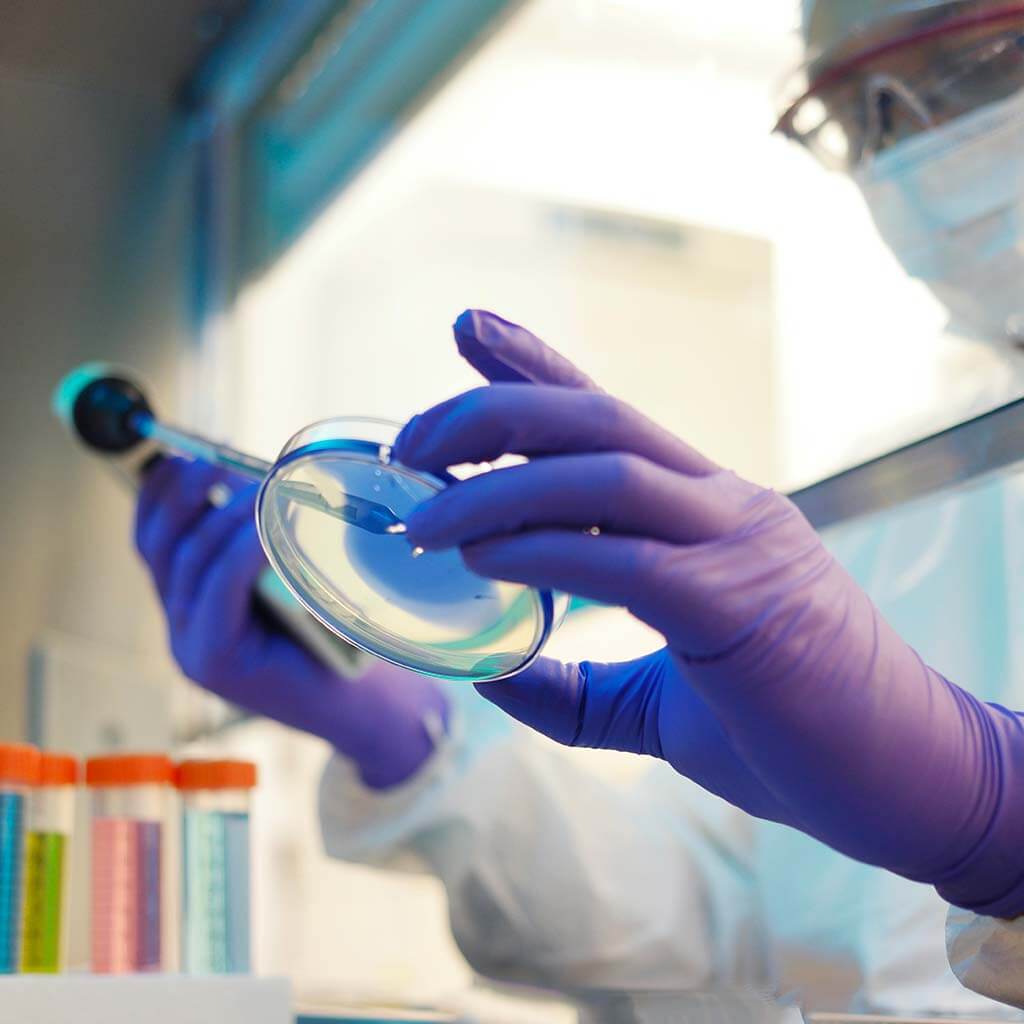 Nutrigenetic test: what it is and when it is needed?