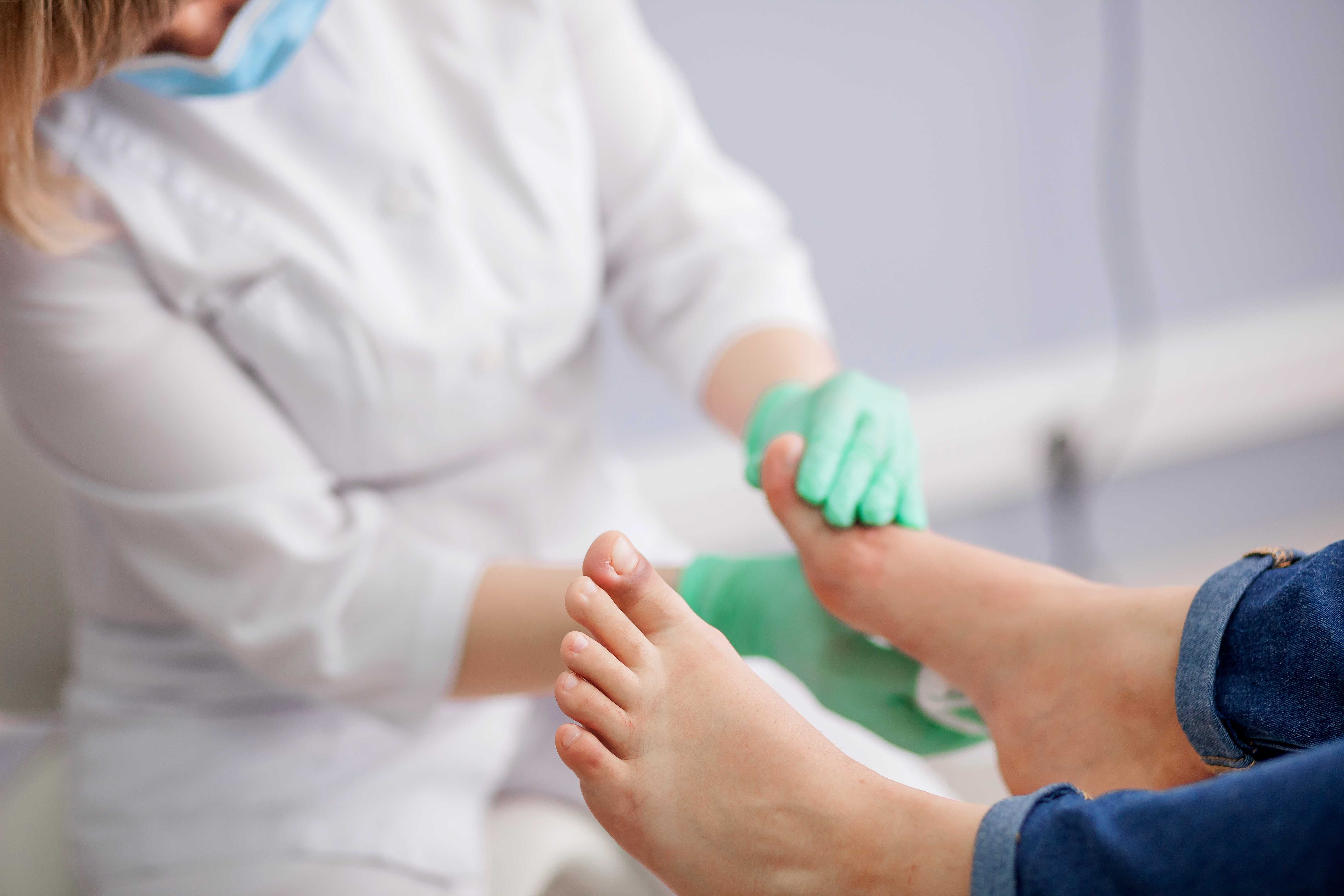 How to recognize hallux valgus and how to treat it