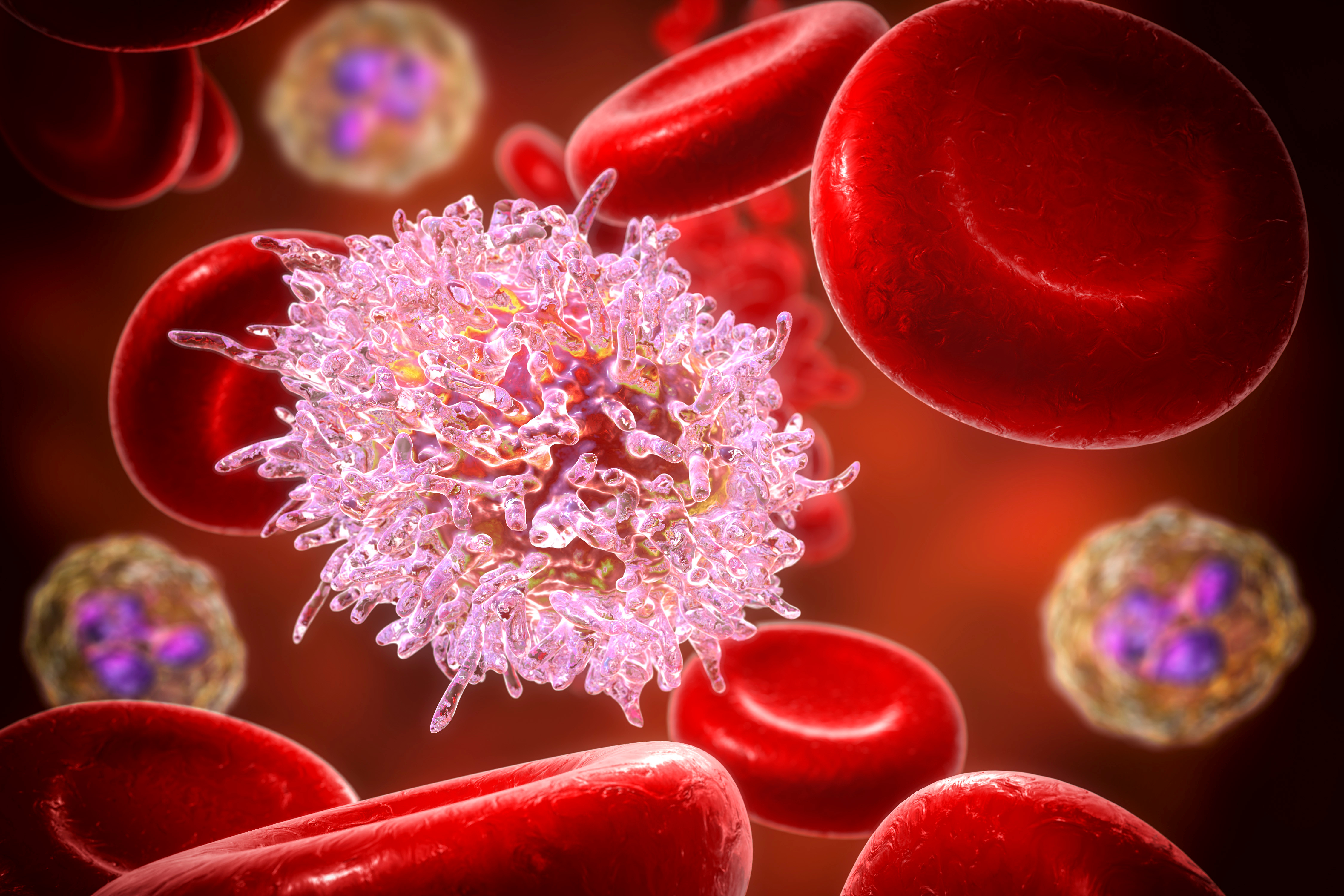 Acute Myeloid Leukemia: Chemotherapy-Induced Senescence Makes Cancer Cells More Visible to the Immune System