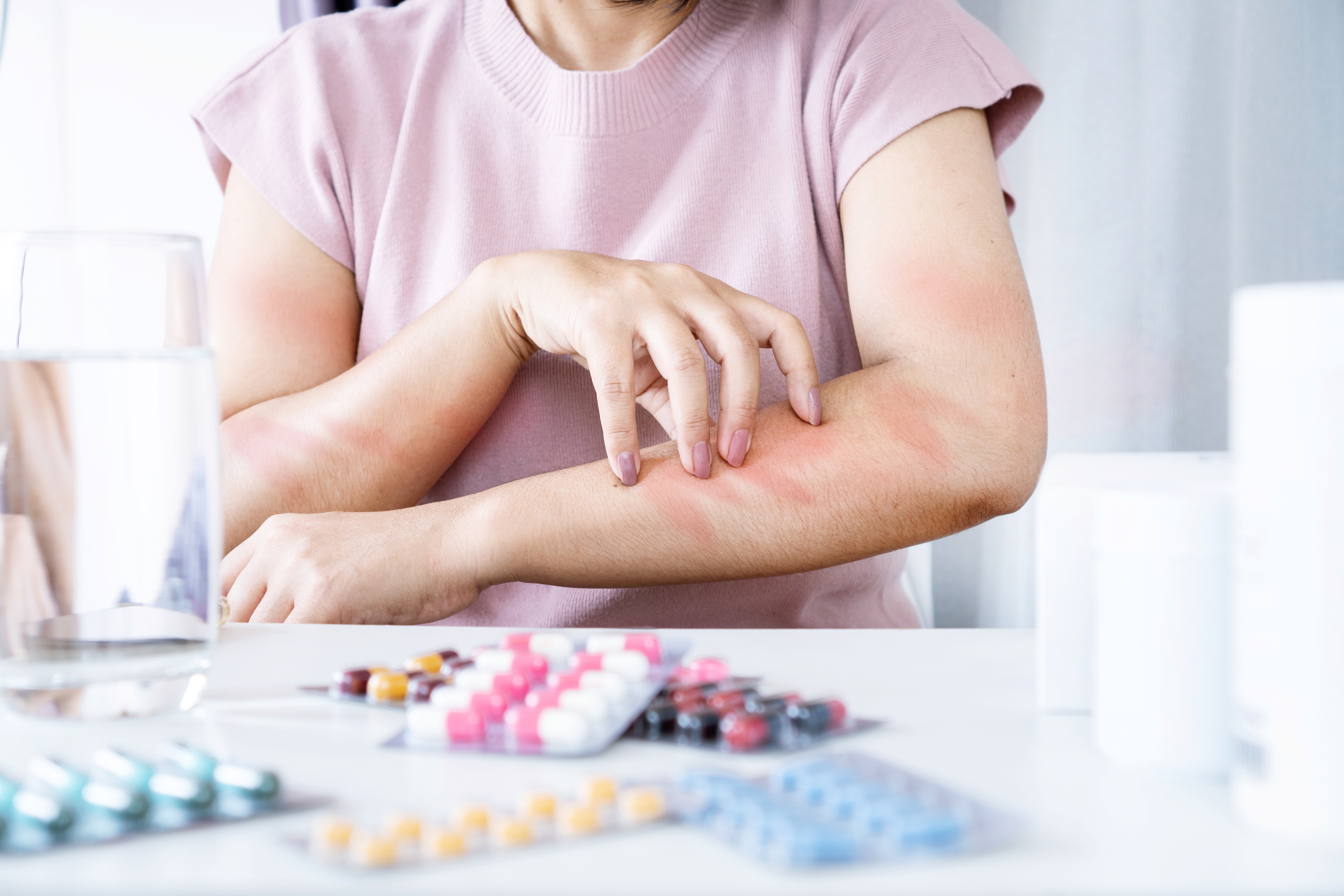 How to Know If You Are Allergic to Medications