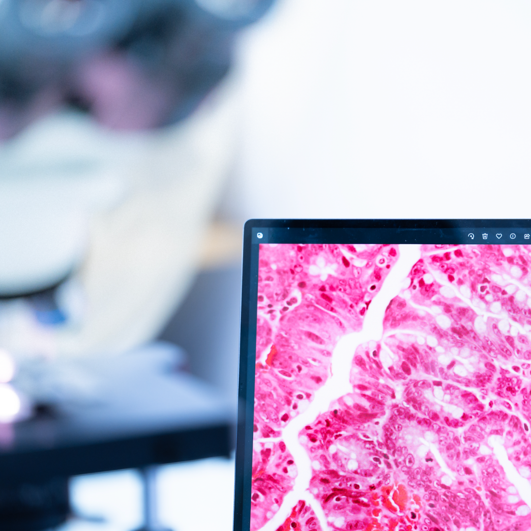 IgG4-Related Disease: New Experimental Treatment Strategies